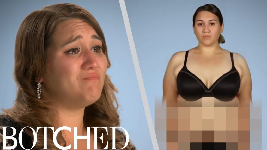 Crystal Wants "Botched" to Fix Her "Christmas Tree Tummy" | E! 1