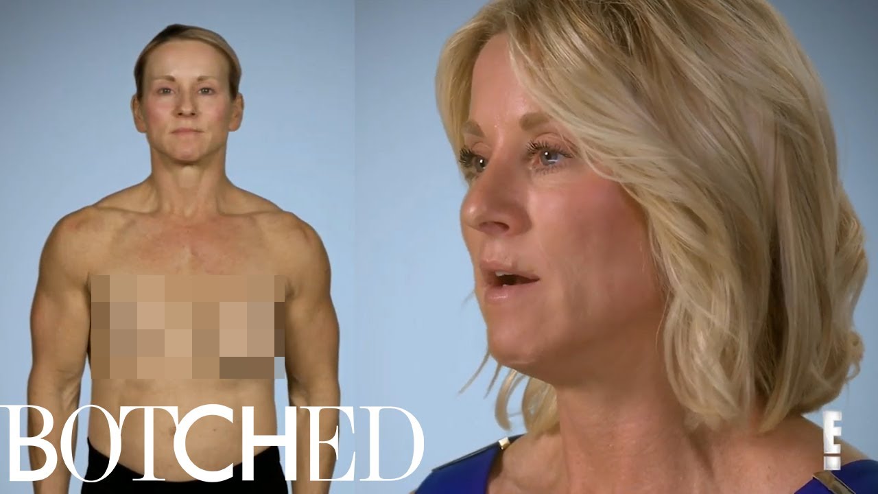 Meet Paula: The One Boob Wonder | Botched | E! 2