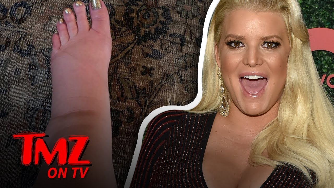 Jessica Simpson's Foot Swells Like a Balloon During Pregnancy | TMZ TV 5