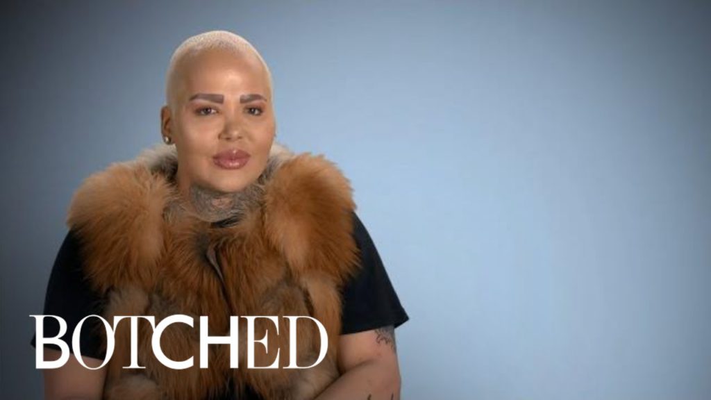 Jordan aka The Lip King Makes His Big Return! | Botched | E! 1