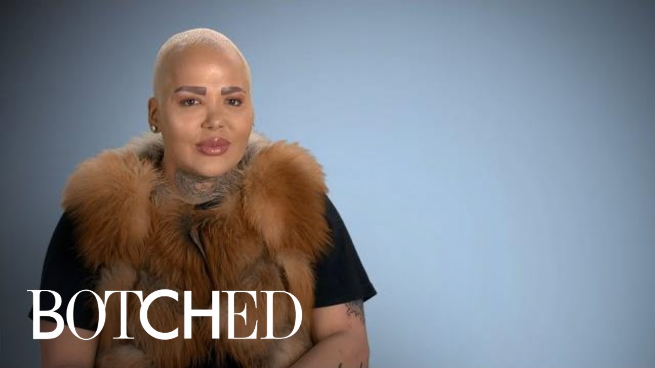 Jordan aka The Lip King Makes His Big Return! | Botched | E! 3