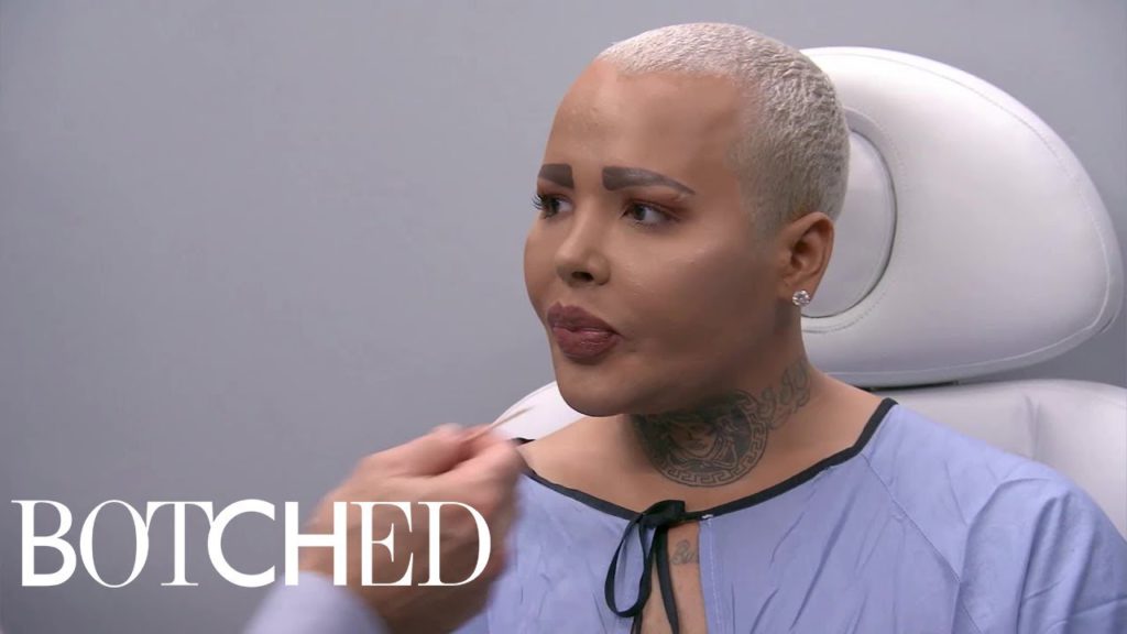 "Botched" Recap: Season 5, Episode 8 1