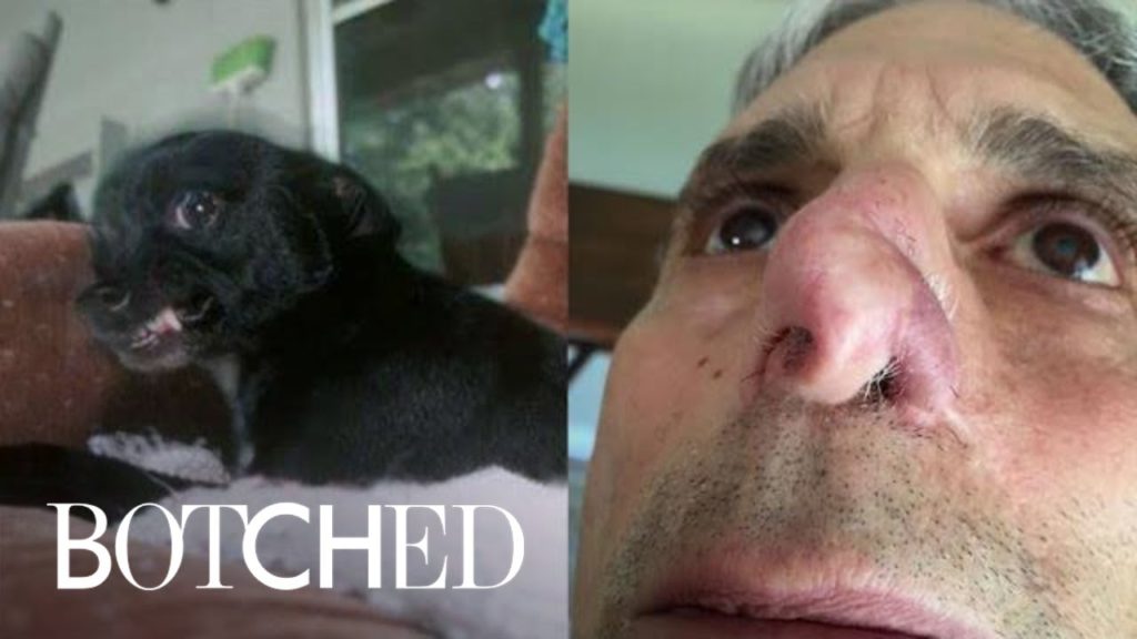 My Name Is Jim, and My Dog Ate My Nose | Botched | E! 1