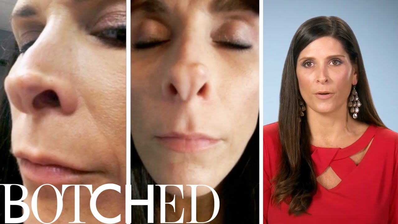 High School Athlete Wants "Hot Mess" Nose Fixed on "Botched" | E! 5