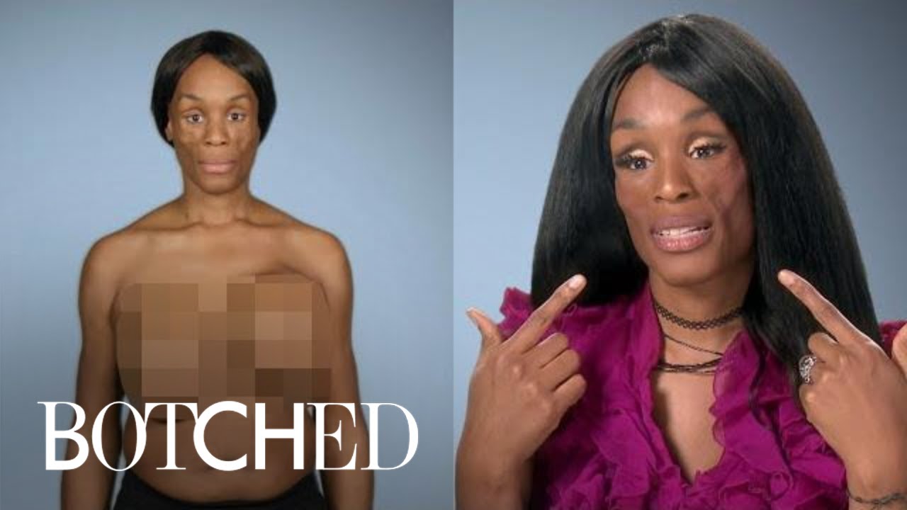 Koffa Wants "Botched" Doctors To Solve Her Medical Mystery | Botched | E! 5