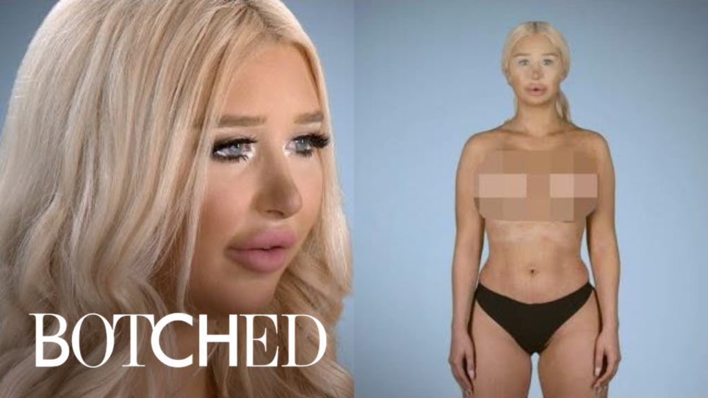 Plastic Surgery Almost Killed Amanda | Botched | E! 1