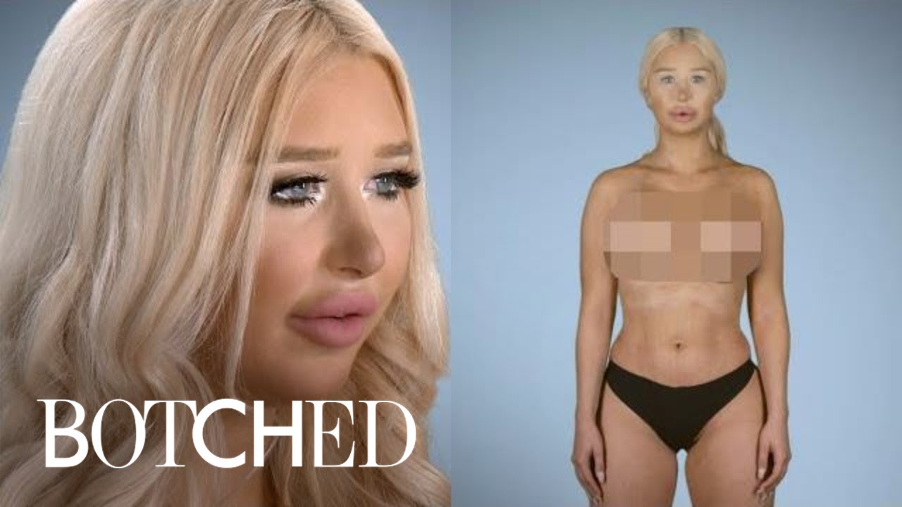 Plastic Surgery Almost Killed Amanda | Botched | E! 1 Plastic Surgery Almost Killed Amanda | Botched | E! 1