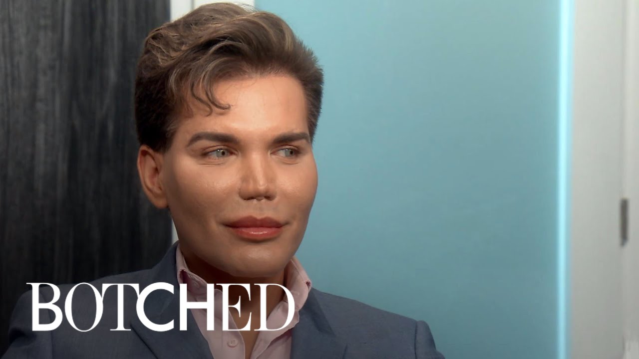 Rodrigo's Nose Underwent How Many Rhinoplasties in 1 Year?! | Botched | E! 3