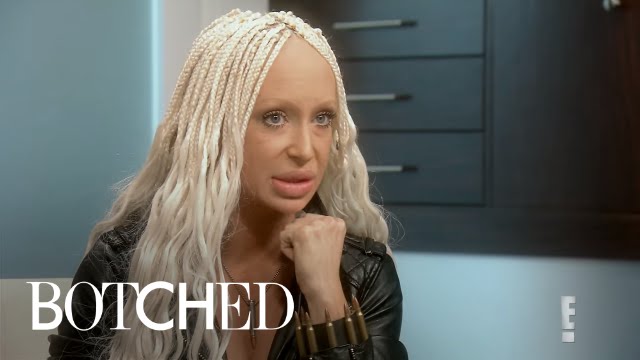 Did Woman Get Sheep's Fat Injected in Lips?! | Botched | E! 2