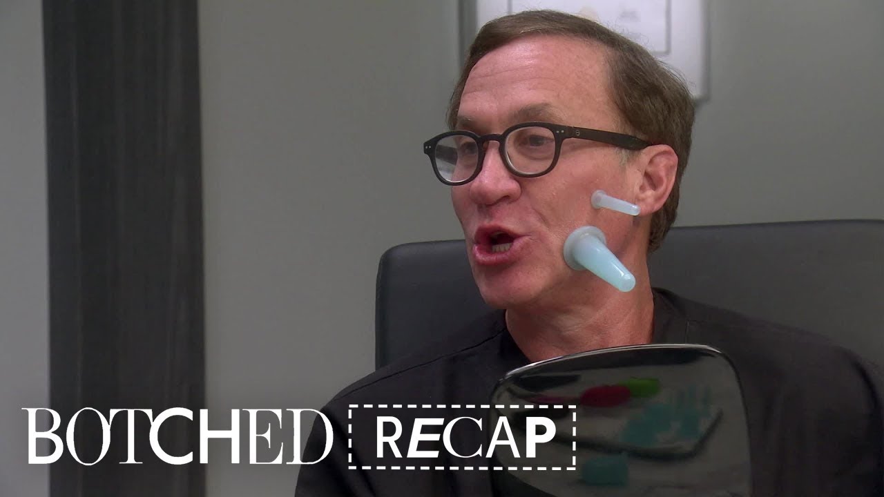 "Botched" Recap (S5 Ep17): Cougars, Cobras and Boobs…Oh My! | E! 2
