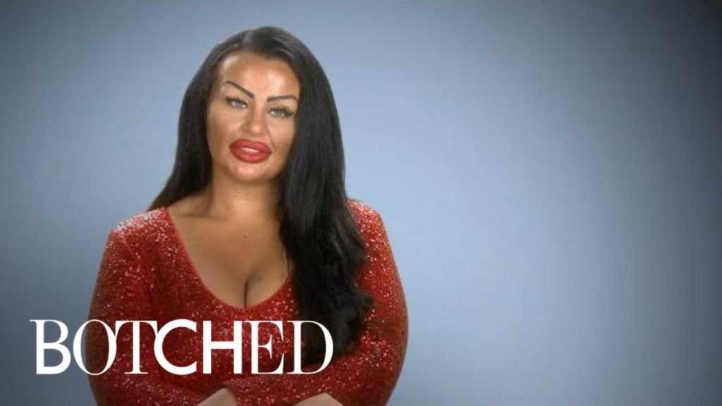 "Botched" Patient Wants Basketball Boobs With Hearts on Front | E! 1