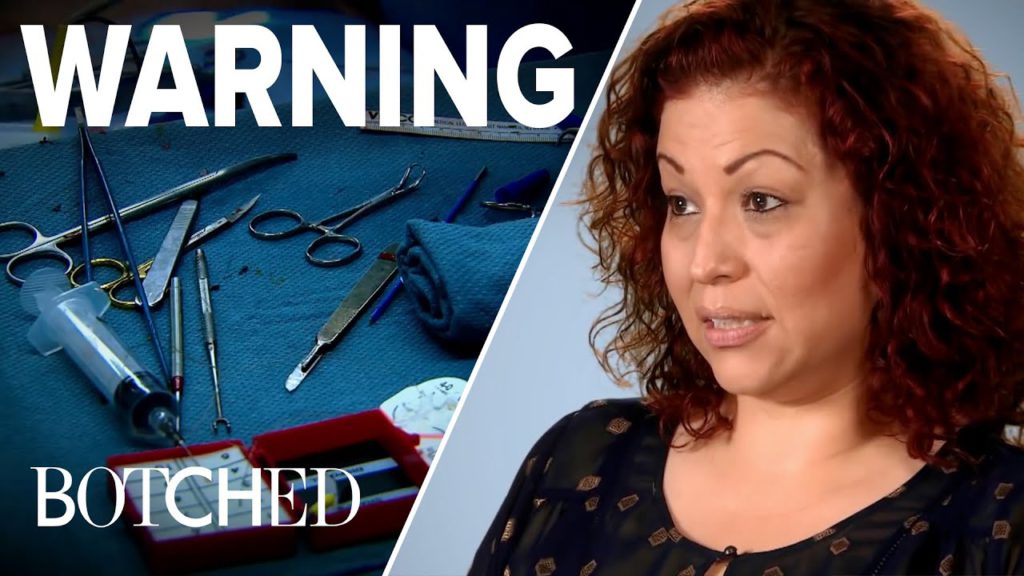 Budget Plastic Surgeries Gone Wrong | Botched | E! 1