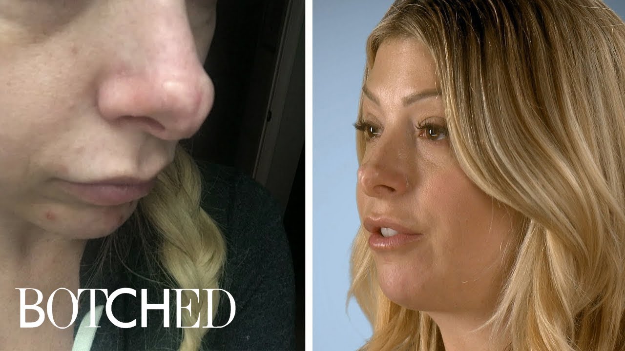 Jennifer Wants Her Jurassic Schnoz Fixed | Botched | E! 3