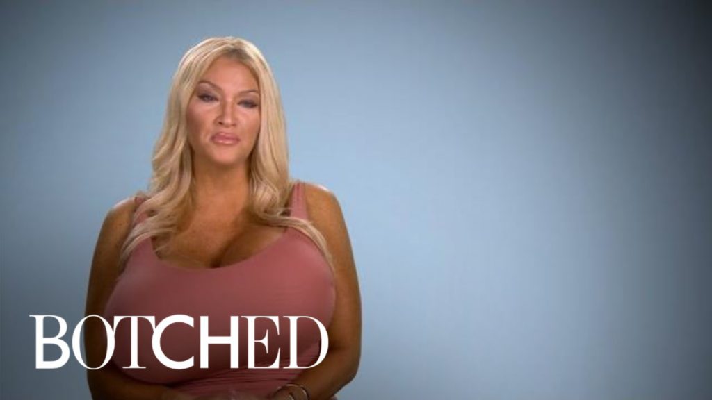 Allegra Explains Her Growing Giant Breasts | Botched | E! 1