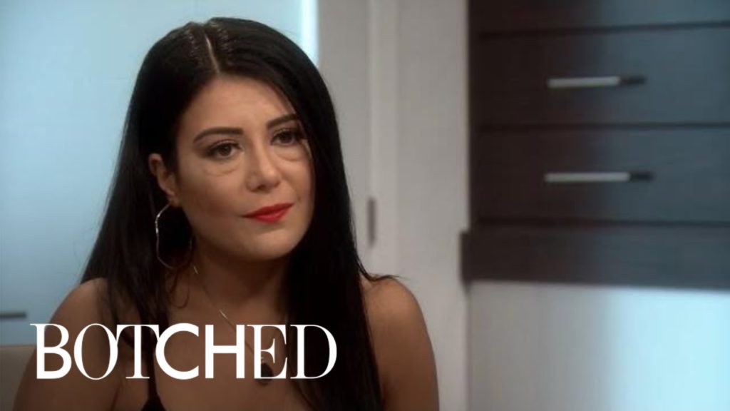 20 Doctors Have Already Turned Down Nuray's Desperate Case | Botched | E! 1