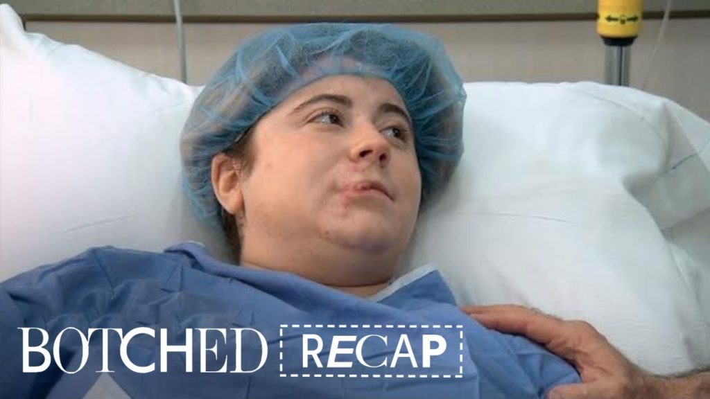 "Botched" Recap: Season 4, Episode 18 | E! 1