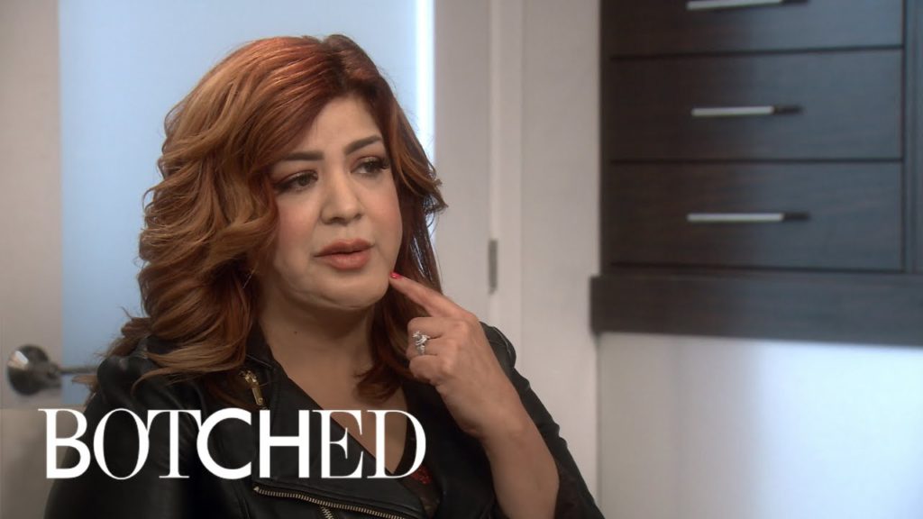 Michelle Got Her Face Worked on By a Drug Addict | Botched | E! 1
