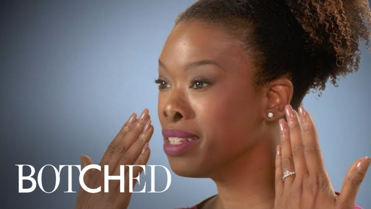 Kelli's Desire for a Smaller Nose Ends in Disaster | Botched | E! 3