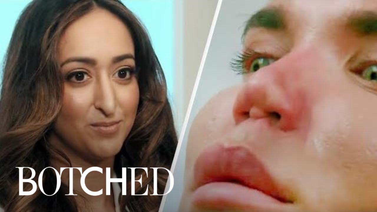 The Most Intense Nose Surgeries From Botched | E! 5