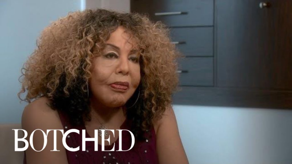 "Botched" Patient Rajee Returns for a 3rd Time | E! 1