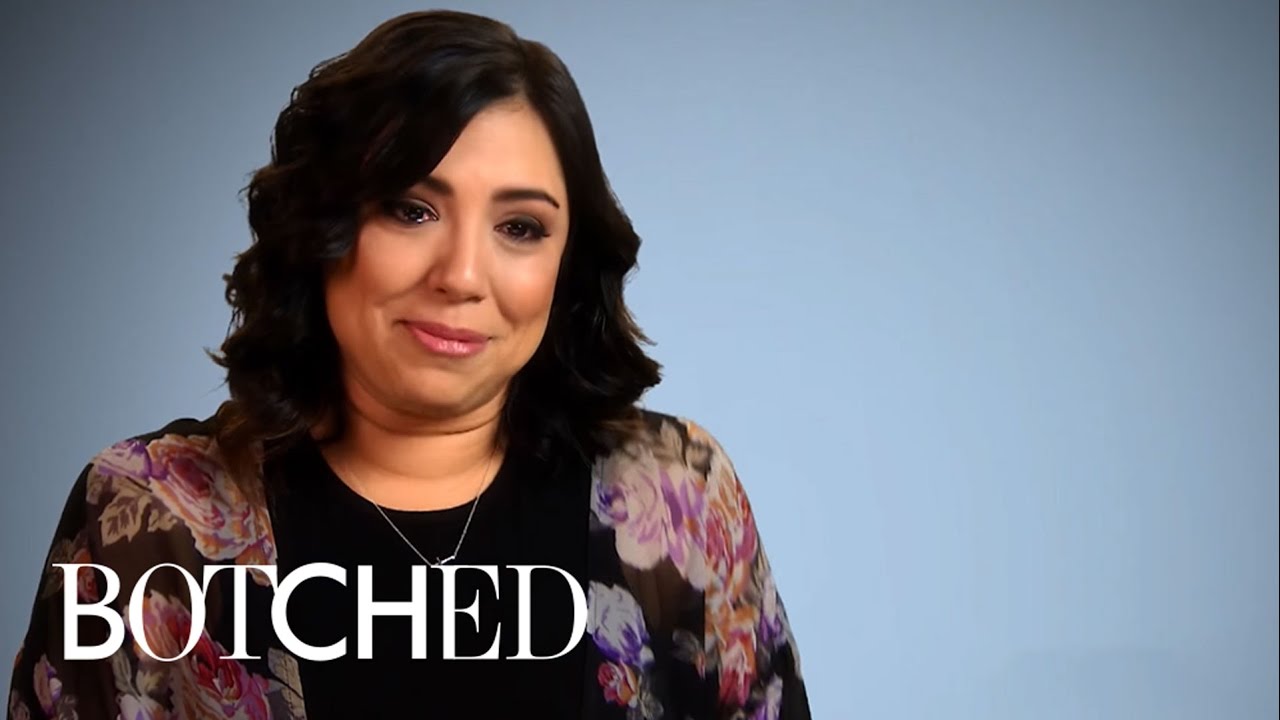 Top 5 Greatest "Botched" Transformations | E! 4