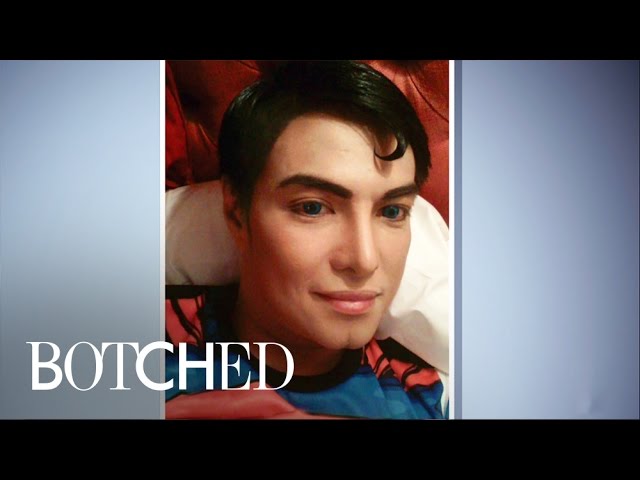 Meet Herbert "Superman" Chavez | Botched | E! 4