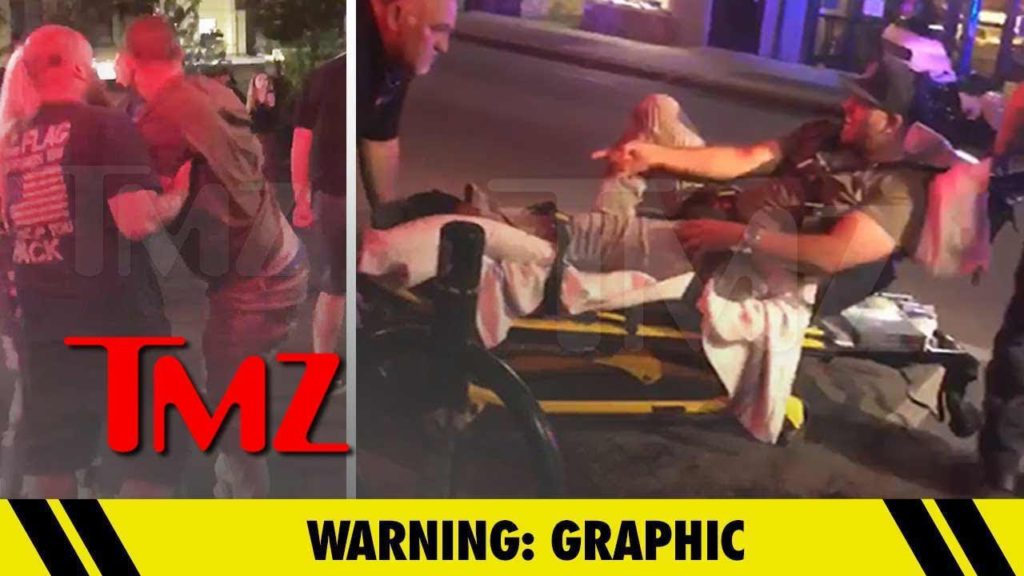 Meghan Markle's Nephew Snapped His Ankle in Drunken Melee | TMZ 1